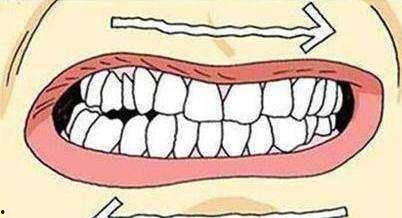 成人磨牙拔牙视频教程,成人磨牙拔牙操作步骤详解视频教程