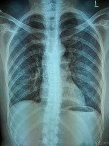 成人脊柱调理方法视频大全,视频大全精选攻略