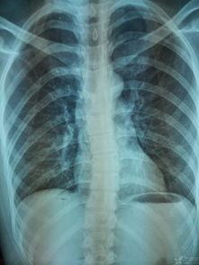 成人脊柱调理方法视频大全,视频大全精选攻略